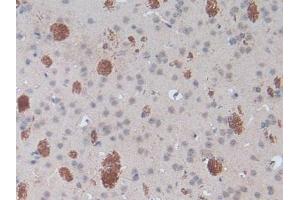 Detection of SPRY1 in Mouse Brain Tissue using Polyclonal Antibody to Sprouty Homolog 1 (SPRY1) (SPRY1 anticorps  (AA 112-303))