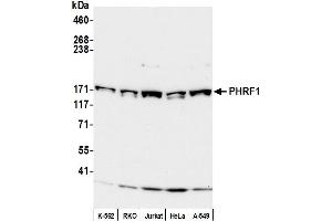 Western Blotting (WB) image for anti-PHD and Ring Finger Domains 1 (PHRF1) (AA 1400-1450) antibody (ABIN7451957) (PHRF1 anticorps  (AA 1400-1450))