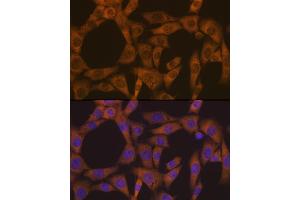 Immunofluorescence analysis of NIH-3T3 cells using CAD Rabbit mAb (ABIN7266064) at dilution of 1:100 (40x lens).