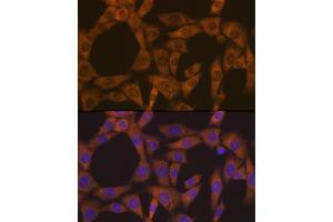 Immunofluorescence analysis of NIH-3T3 cells using CAD Rabbit mAb (ABIN7266064) at dilution of 1:100 (40x lens). (CAD anticorps)