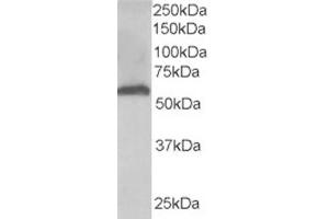 Western Blotting (WB) image for anti-Formiminotransferase Cyclodeaminase (FTCD) (N-Term) antibody (ABIN2465215) (FTCD anticorps  (N-Term))