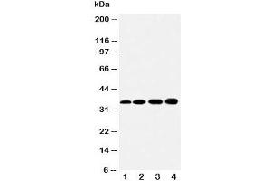Western blot testing of HSD17B1 antibody and Lane 1:  rat kidney;  2: rat liver;  3: 293T;  4: HeLa cell lysate (HSD17B1 anticorps  (AA 29-43))