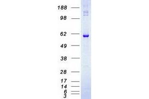 Validation with Western Blot
