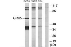 Western blot analysis of extracts from HeLa/HepG2/HuvEc cells, using GRK5 Antibody. (GRK5 anticorps  (AA 351-400))