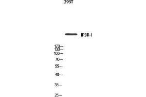 Western Blot (WB) analysis of 293T using IP3R-I antibody. (ITPR1 anticorps)