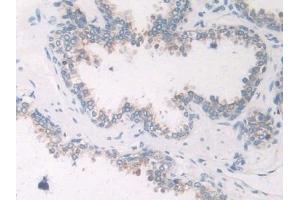 Detection of NCCT in Human Prostate Tissue using Polyclonal Antibody to Na-Cl Cotransporter (NCCT)