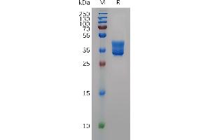 Human Protein, hFc Tag on SDS-PAGE under reducing condition.