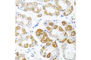 Immunohistochemistry of paraffin-embedded human stomach using CCL2 antibody at dilution of 1:100 (40x lens). (CCL2 anticorps)