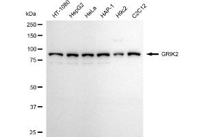 Western blotting analysis using GRIK2 antibody (ABIN7798739).