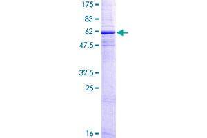 Image no. 1 for Membrane-Spanning 4-Domains, Subfamily A, Member 1 (MS4A1) (AA 1-297) protein (GST tag) (ABIN1311400)