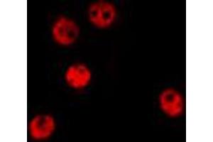 ABIN6274374 staining HepG2 by IF/ICC. (TSC22D1 anticorps  (C-Term))