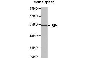 Western Blotting (WB) image for anti-Interferon Regulatory Factor 4 (IRF4) (AA 150-350) antibody (ABIN1680506) (IRF4 anticorps  (AA 150-350))