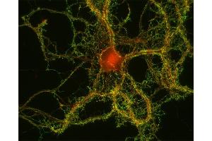 Immunocytochemistry (ICC) image for anti-Catenin, beta (CATNB) (AA 768-782) antibody (ABIN1742544)