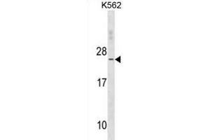 TNNC2 Antibody (C-term) (ABIN1881894 and ABIN2838656) western blot analysis in K562 cell line lysates (35 μg/lane). (TNNC2 anticorps  (C-Term))
