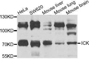 Western blot analysis of extracts of various cell lines, using ICK antibody (ABIN5974764) at 1/1000 dilution. (ICK anticorps)