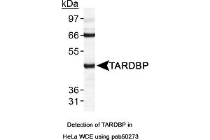 Image no. 1 for anti-TAR DNA Binding Protein (TARDBP) (AA 350-414), (C-Term) antibody (ABIN363582) (TARDBP anticorps  (C-Term))