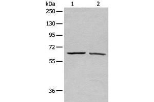 Western blot analysis of A431 and Hela cell lysates using ATAD3A Polyclonal Antibody at dilution of 1:500 (ATAD3A anticorps)