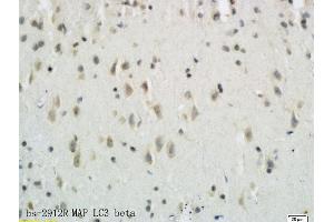 Formalin-fixed and paraffin embedded rat brain tissue labeled with Anti-LC3B/MAP LC3? (MAP1LC3A/B anticorps  (AA 21-121))