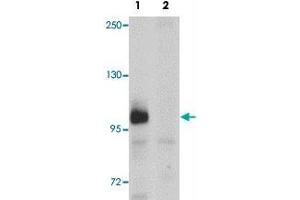 Western blot analysis of ZC3HAV1 in HeLa cell lysate with ZC3HAV1 polyclonal antibody  at 1ug/mL in (1) the absence and (2) the presence of blocking peptide. (ZC3HAV1 anticorps  (C-Term))