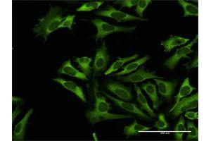 Immunofluorescence of purified MaxPab antibody to RARS on HeLa cell.