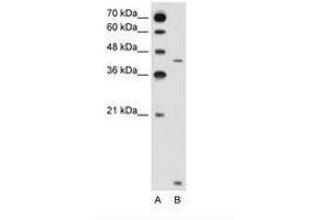 Image no. 2 for anti-Solute Carrier Family 46, Member 3 (SLC46A3) (N-Term) antibody (ABIN205029) (SLC46A3 anticorps  (N-Term))