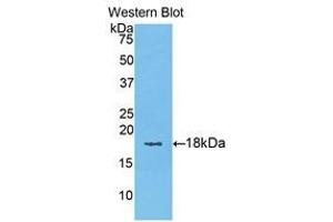 Western Blotting (WB) image for anti-Keratin 6A (KRT6A) (AA 323-461) antibody (ABIN1176074)