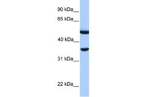 Western Blotting (WB) image for anti-DnaJ (Hsp40) Homolog, Subfamily B, Member 6 (DNAJB6) antibody (ABIN2459535) (DNAJB6 anticorps)