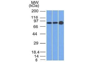Western Blot of U87, HeLa and A431 cell lysates using Plakophilin-1 Mouse Monoclonal Antibody (10B2) (Plakophilin 1 anticorps  (N-Term))