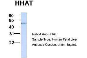 Host:  Rabbit  Target Name:  HHAT  Sample Type:  Human Fetal Liver  Antibody Dilution:  1. (HHAT anticorps  (N-Term))