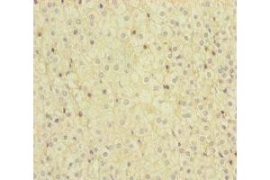 Immunohistochemistry of paraffin-embedded human adrenal gland tissue using ABIN7159656 at dilution of 1:100 (MMACHC anticorps  (AA 63-282))