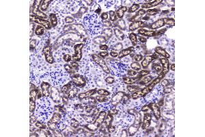 IHC analysis of CES1 using anti-CES1 antibody .