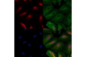 ABIN6260295 and ABIN6279783 staining  cells by IF/ICC. (BMS1 anticorps  (C-Term))