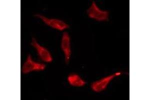 ABIN6276193 staining HT29 by IF/ICC. (OR8S1 anticorps  (Internal Region))
