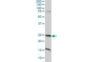 MRRF monoclonal antibody (M01), clone 1D3 Western Blot analysis of MRRF expression in A-431 .