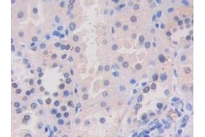 Detection of VAV3 in Human Kidney Tissue using Polyclonal Antibody to Vav 3 Oncogene (VAV3) (VAV3 anticorps  (AA 398-583))