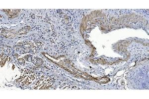 IHC analysis of Alpha B Crystallin/CRYAB using anti-Alpha B Crystallin/CRYAB antibody (ABIN7601209). (CRYAB anticorps  (AA 30-151))