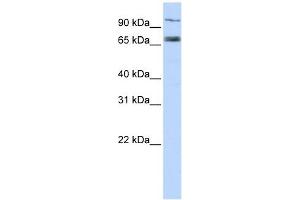 TAP1 antibody used at 1 ug/ml to detect target protein. (TAP1 anticorps)
