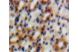 Used in DAB staining on fromalin fixed paraffin-embedded Kidney tissue