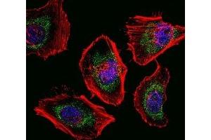 Fluorescent confocal image of HeLa cells stained with SOX4 antibody. (SOX4 anticorps  (AA 86-114))