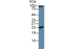 Western Blot; Sample: Mouse Cerebrum lysate; Primary Ab: 1µg/ml Rabbit Anti-Mouse FTL Antibody Second Ab: 0. (FTL anticorps  (AA 5-183))
