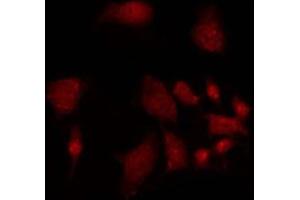 ABIN6275491 staining 293 by IF/ICC. (ARHGAP18 anticorps  (Internal Region))