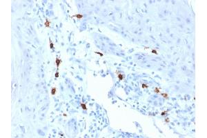 Formalin-fixed, paraffin-embedded human Skin stained with Tryptase Mouse Monoclonal Antibody (TPSAB1/1963). (TPSAB1 anticorps  (AA 115-233))