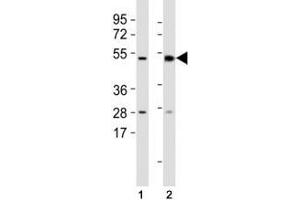 Western blot testing of Mlkl antibody at 1:1000 dilution and mouse samples: (1) lung, (2) spleen lysate; Predicted size: 54 kDa. (MLKL anticorps  (AA 444-472))