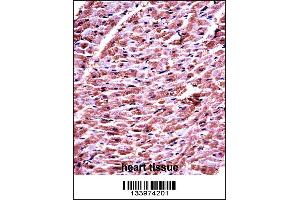 DHRS7C Antibody immunohistochemistry analysis in formalin fixed and paraffin embedded human heart tissue followed by peroxidase conjugation of the secondary antibody and DAB staining.