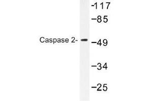 Image no. 1 for anti-Caspase 2, Apoptosis-Related Cysteine Peptidase (CASP2) antibody (ABIN317792) (Caspase 2 anticorps)