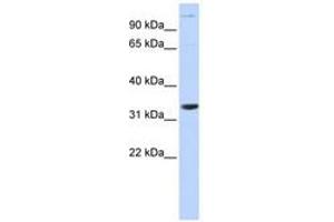 Image no. 1 for anti-Acidic (Leucine-Rich) Nuclear phosphoprotein 32 Family, Member B (ANP32B) (AA 36-85) antibody (ABIN6741124) (ANP32B anticorps  (AA 36-85))