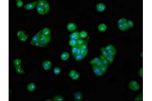 Immunofluorescence staining of HepG2 cells with ABIN7159581 at 1:100, counter-stained with DAPI. (METAP2 anticorps  (AA 313-449))