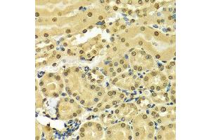 Immunohistochemistry of paraffin-embedded Mouse kidney using HNRNPA2B1 antibody at dilution of 1:100 (x400 lens). (HNRNPA2B1 anticorps  (AA 1-180))