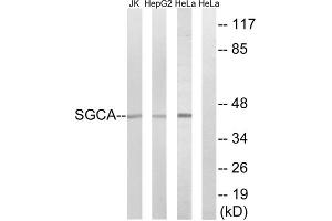 Western blot analysis of extracts from Jurkat cells, HepG2 cells and HeLa cells, using SGCA antibody. (SGCA anticorps  (Internal Region))
