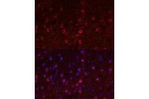 Immunofluorescence analysis of rat brain using SLC1 antibody (ABIN6131630, ABIN6147868, ABIN6147869 and ABIN6219899) at dilution of 1:100.